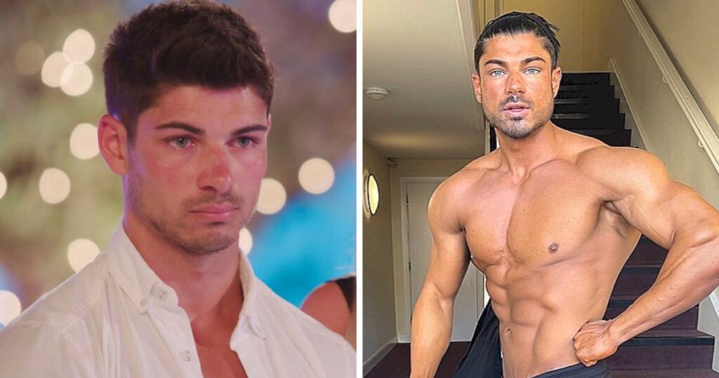 Transformation before and after of Anton from Love Island