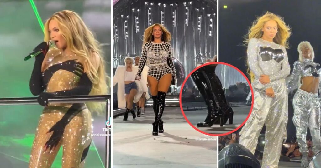 Beyoncé injury foot surgery