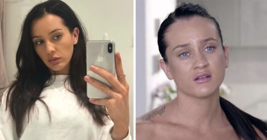 Ines from MAFS Australia who has had surgery