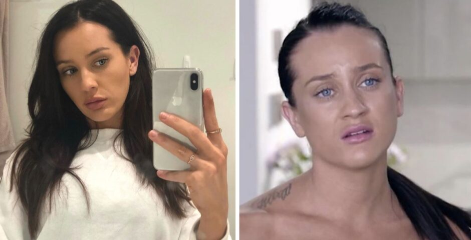 Ines from MAFS Australia who has had surgery