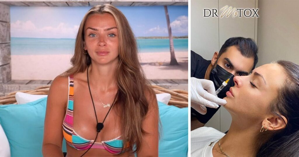 Love Island star Kady McDermott having cosmetic surgery work