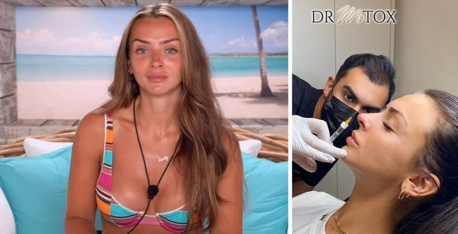 Love Island star Kady McDermott having cosmetic surgery work