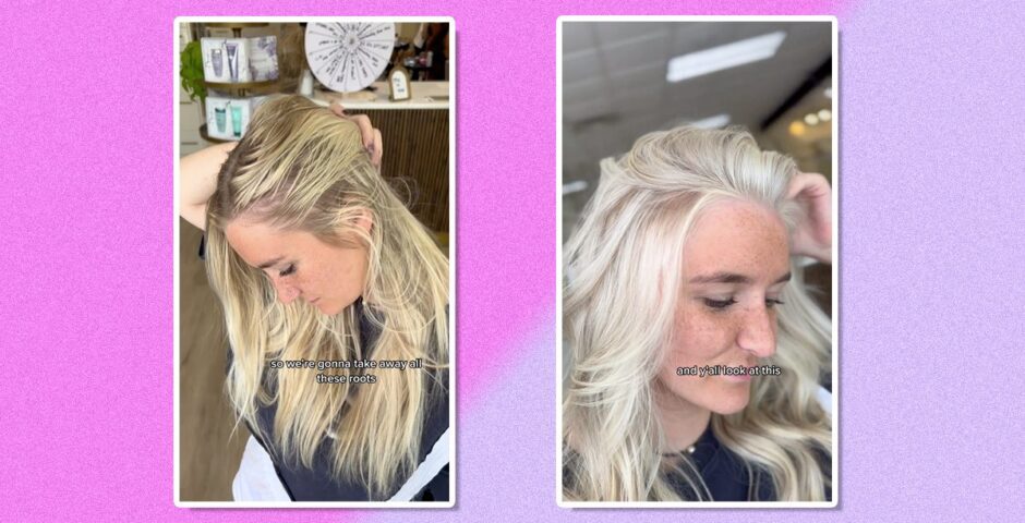 scandi hairline