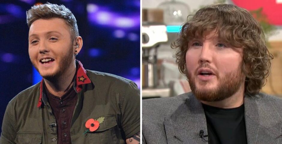 James Arthur transformation