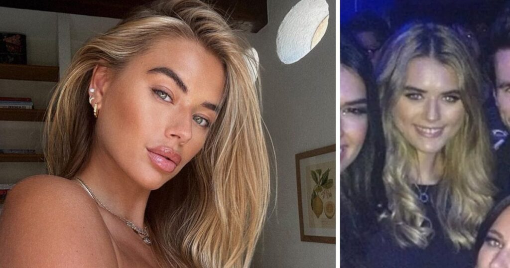 Love Island All Stars cast member Arabella Chi talks cosmetic surgery