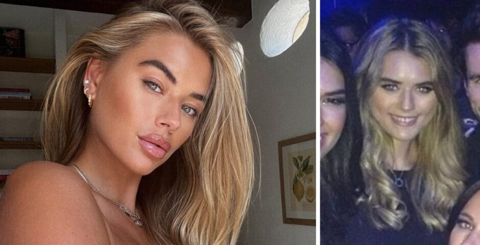 Love Island All Stars cast member Arabella Chi talks cosmetic surgery