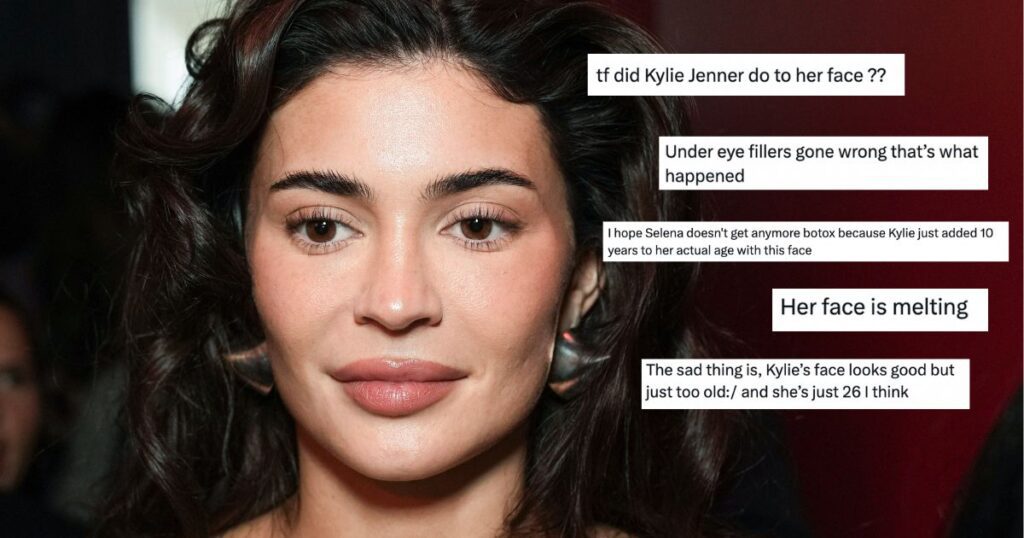 Kylie Jenner face before and after what went wrong age