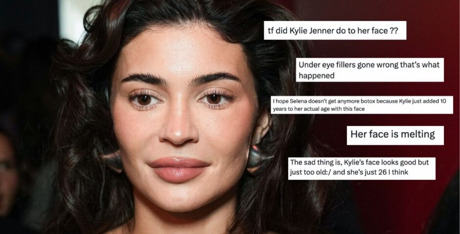 Kylie Jenner face before and after what went wrong age