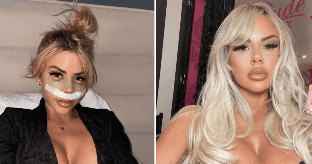 Hannah Love Island All Stars cosmetic surgery