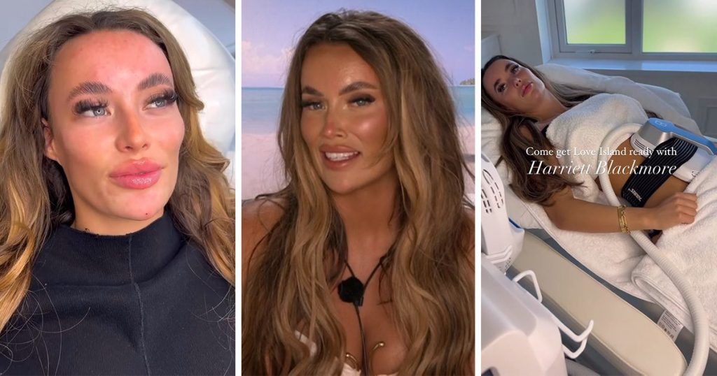 Harriett Blackmore transformation before Love Island 2024 and cosmetic surgery