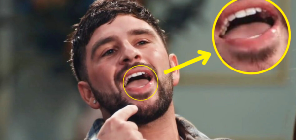 mafs uk 2024 kieran cold sore