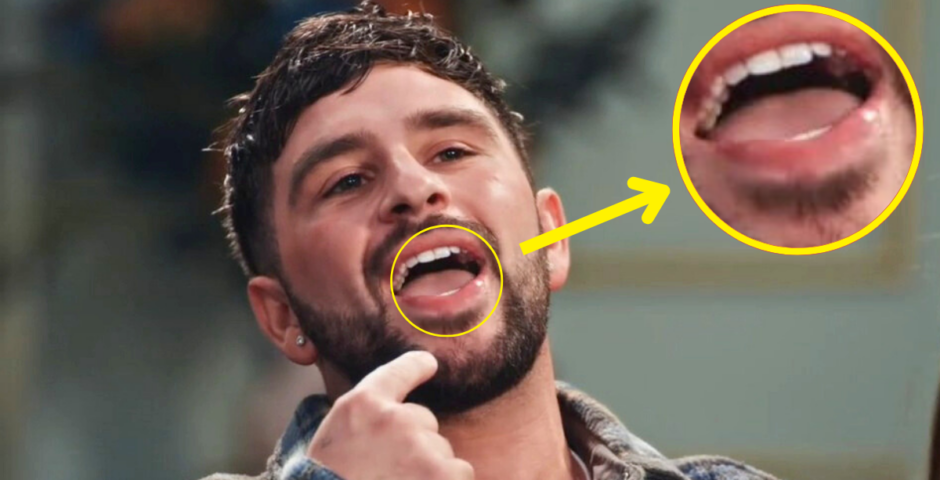 mafs uk 2024 kieran cold sore