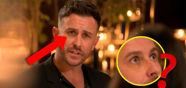 nick the ultimatum black eye