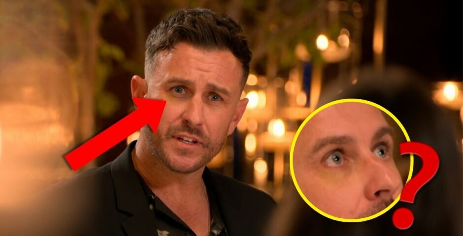 nick the ultimatum black eye