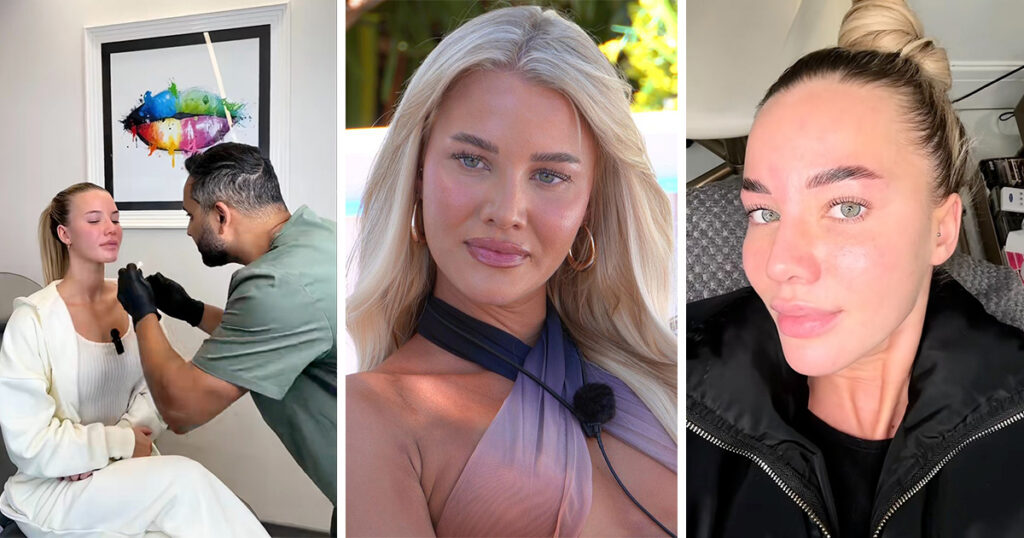 Grace Jackson cosmetic work before Love Island All Stars