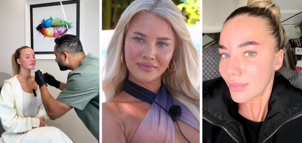Grace Jackson cosmetic work before Love Island All Stars