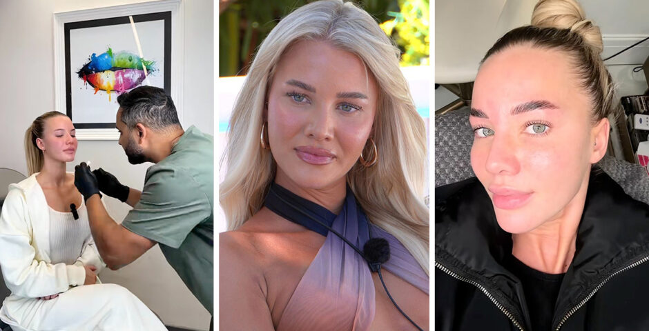 Grace Jackson cosmetic work before Love Island All Stars