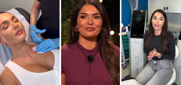 India Reynolds cosmetic work and transformation for Love Island All Stars