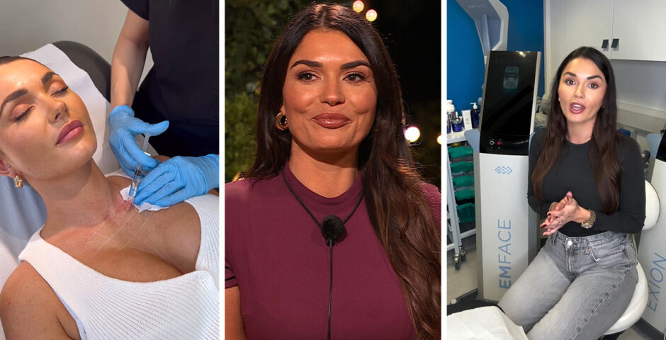 India Reynolds cosmetic work and transformation for Love Island All Stars