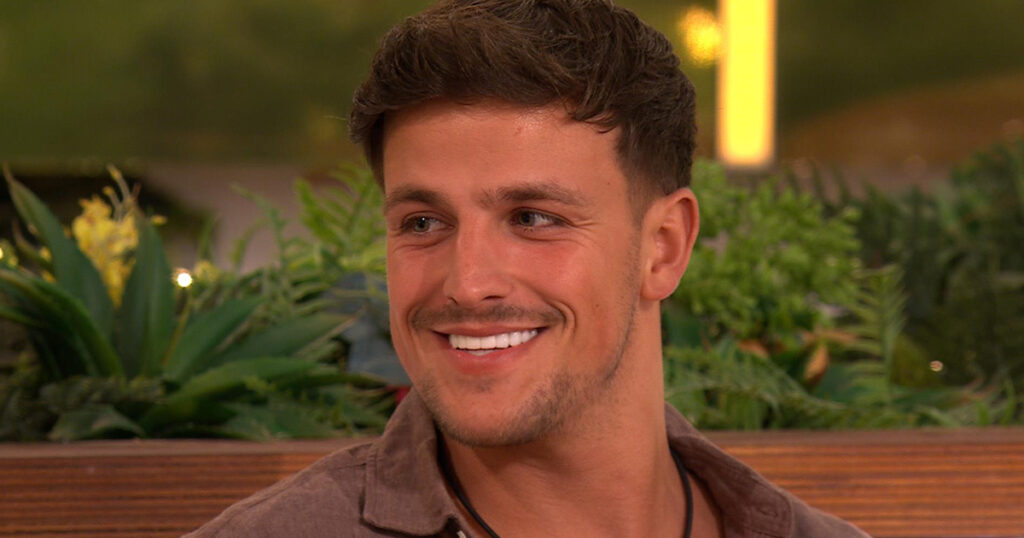 Luca Bish skin condition Love Island All Stars
