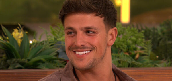 Luca Bish skin condition Love Island All Stars