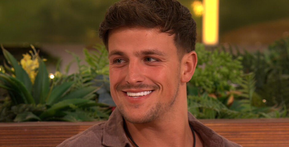 Luca Bish skin condition Love Island All Stars