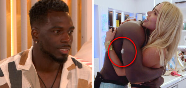 Marcel wearing a patch in Love Island All Stars villa
