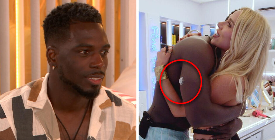 Marcel wearing a patch in Love Island All Stars villa