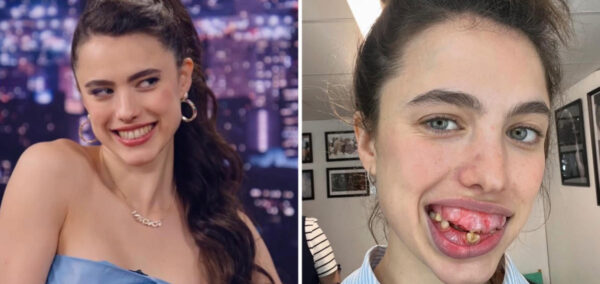 Margaret Qualley The Substance prosthetics