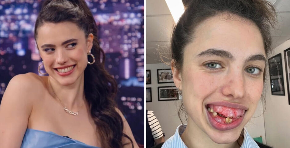 Margaret Qualley The Substance prosthetics