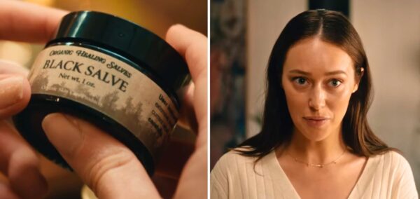 netflix apple cider vinegar milla black salve