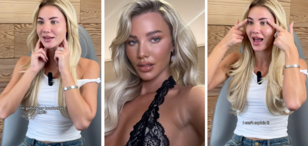 Grace Love Island All Stars cosmetic work