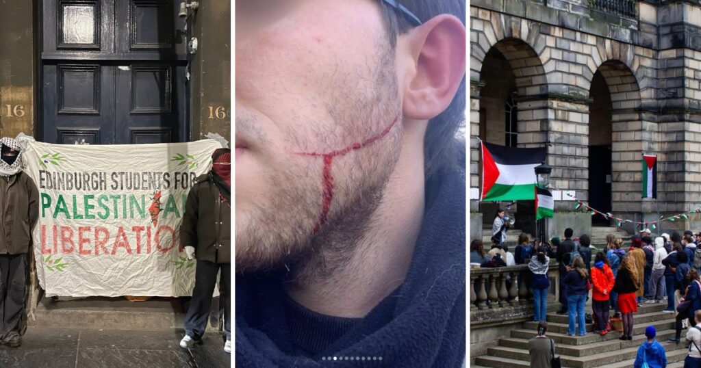 edinburgh protest attack