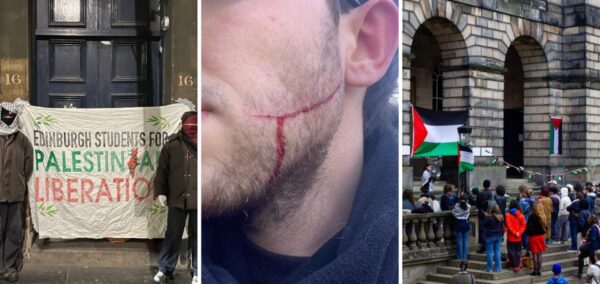 edinburgh protest attack