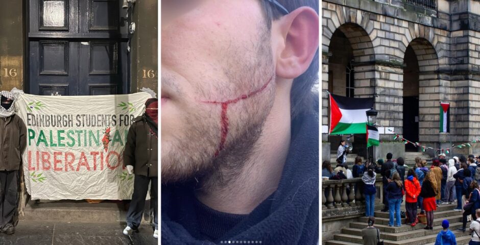 edinburgh protest attack