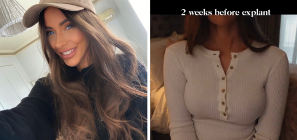 Influencer Danielle Mansutti is suing her doctor over boob job