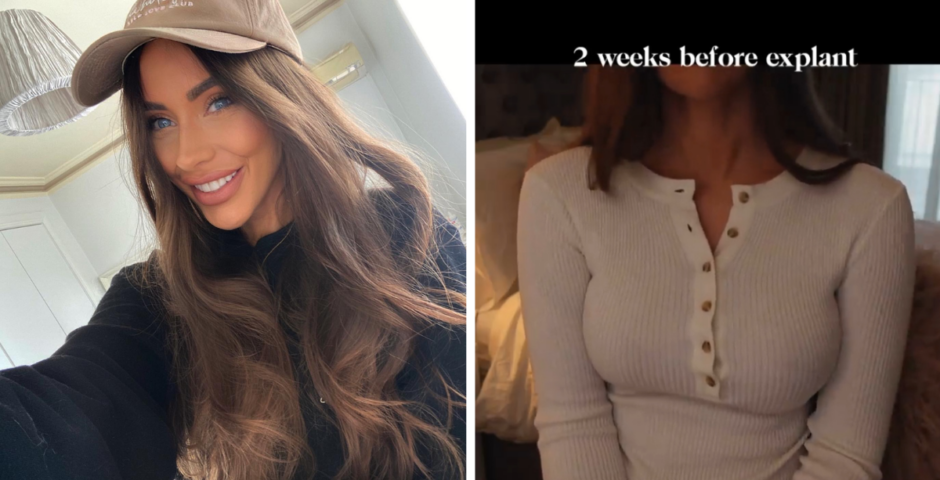 Influencer Danielle Mansutti is suing her doctor over boob job