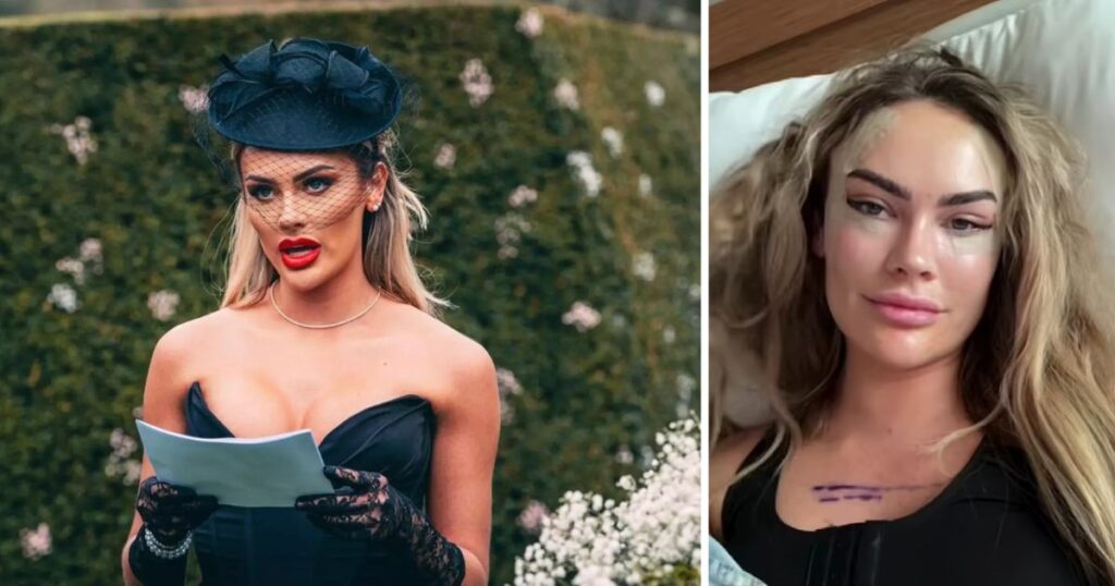 mafs uk amy kenyon surgery