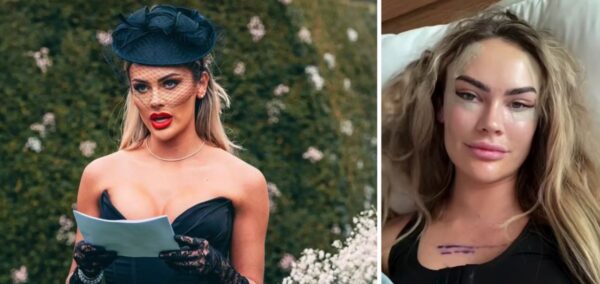 mafs uk amy kenyon surgery