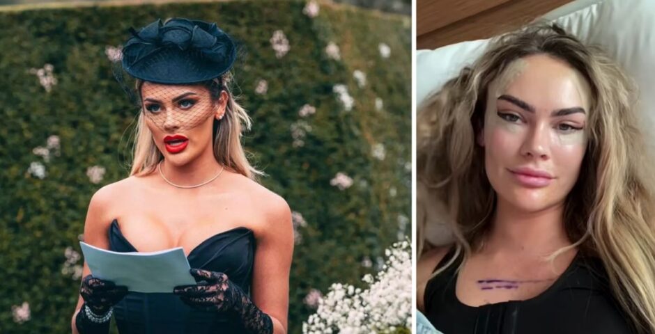 mafs uk amy kenyon surgery