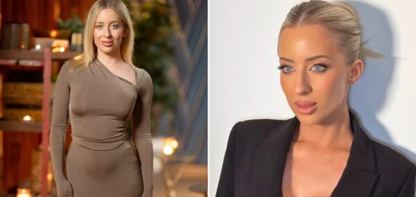 mafs australia 2025 jamie marinos cosmetic surgery
