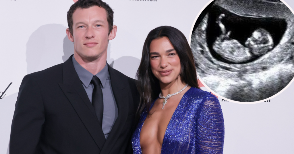 Rumour Dua Lipa is pregnant