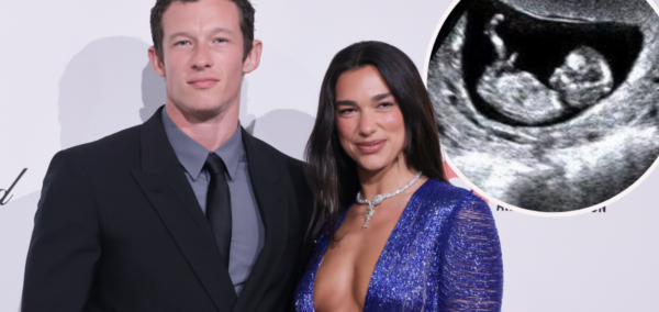 Rumour Dua Lipa is pregnant
