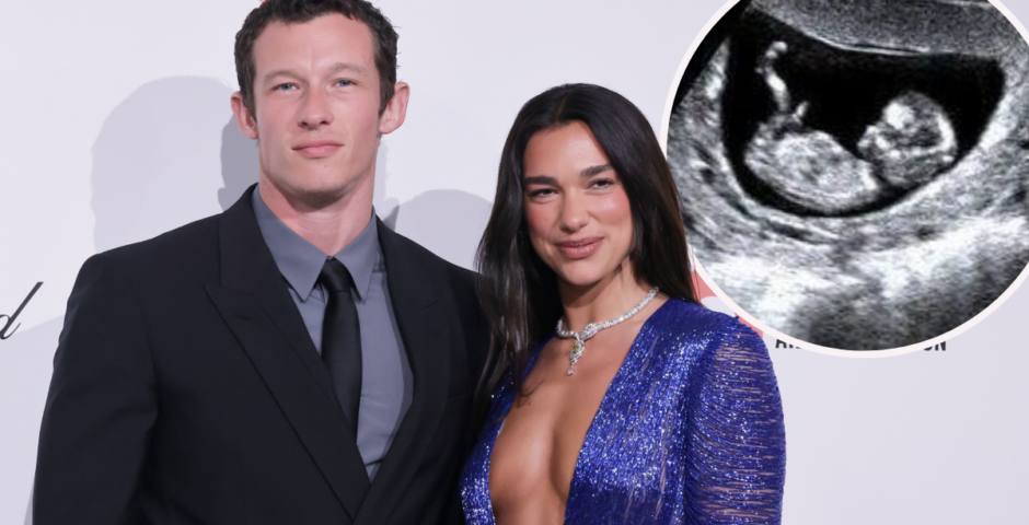 Rumour Dua Lipa is pregnant