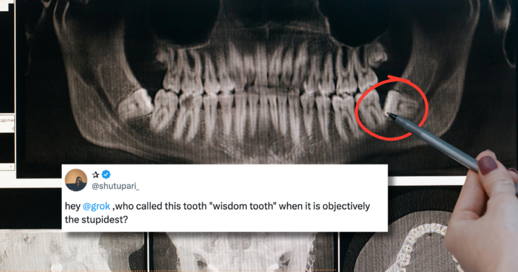 why Wisdom teeth called