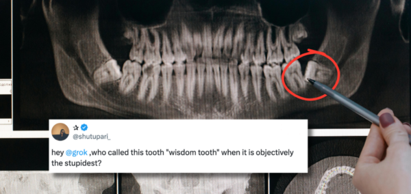 why Wisdom teeth called