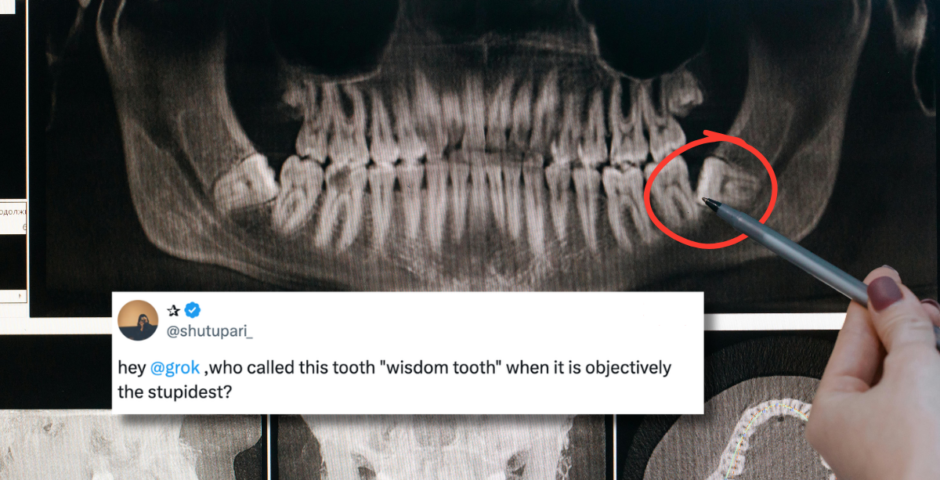 why Wisdom teeth called