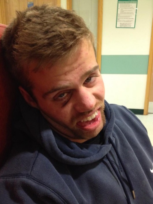 Loose forward Oli Pestell looking a little worse for wear after being knocked unconscious in a collision