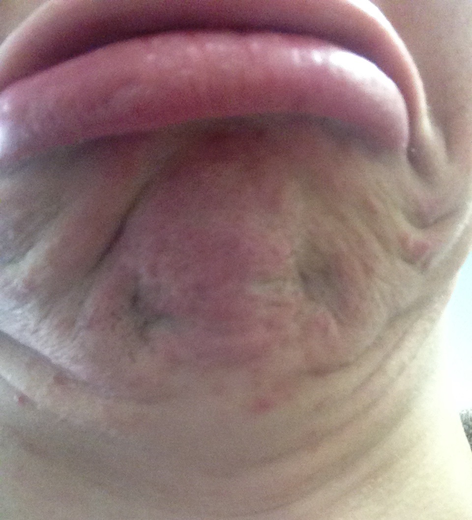 I'm sexy and I know it.