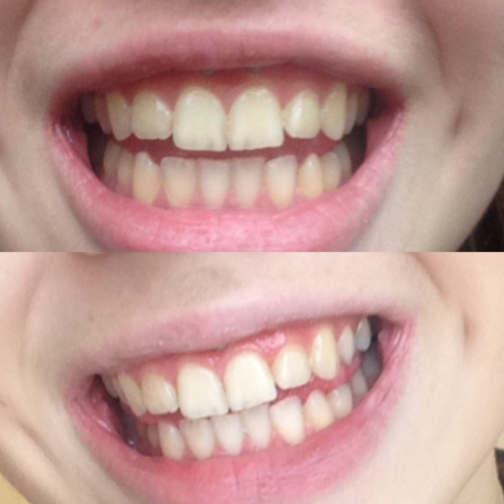 Top = before Bottom = After